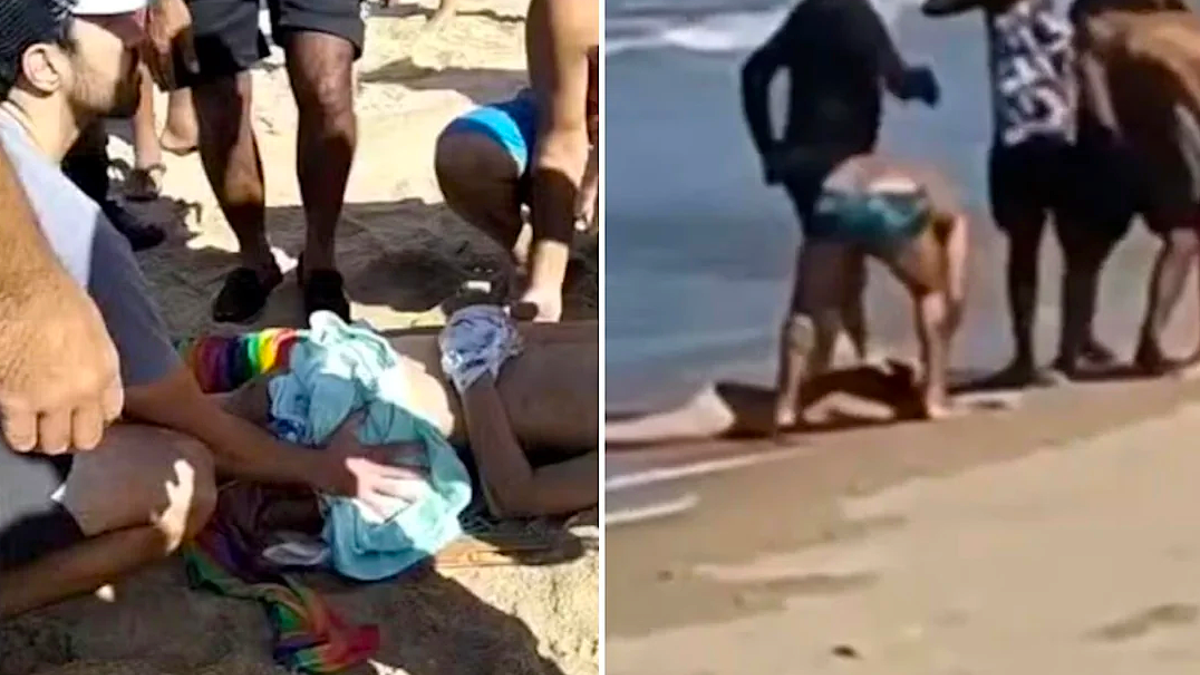 ‘Don’t Let Me Die’: 11-Year-Old Loses Leg in Brazil Shark Attack 