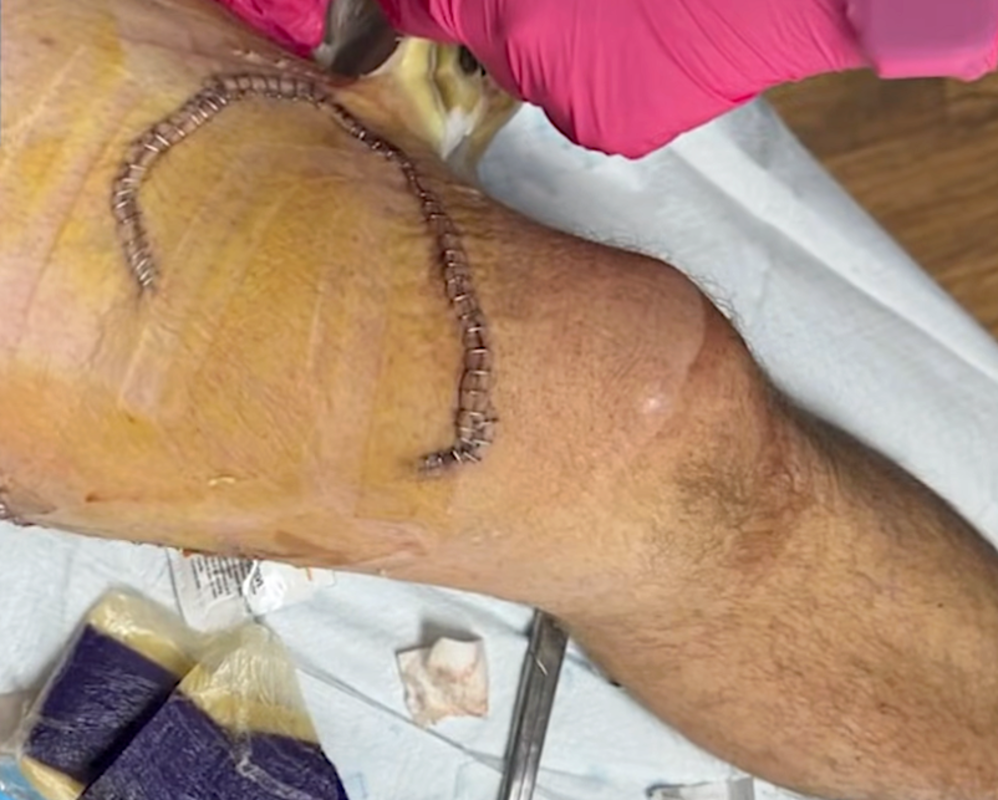 Fisherman Saves Shark in Hawaii - Heartbreaking Video - News Directory 3