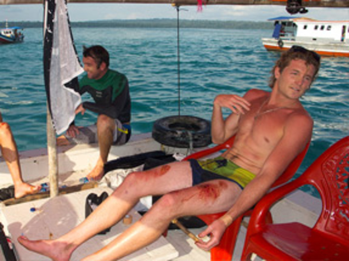 What is Surf Rash and How Can You Treat It? - SETT – SETT Surf