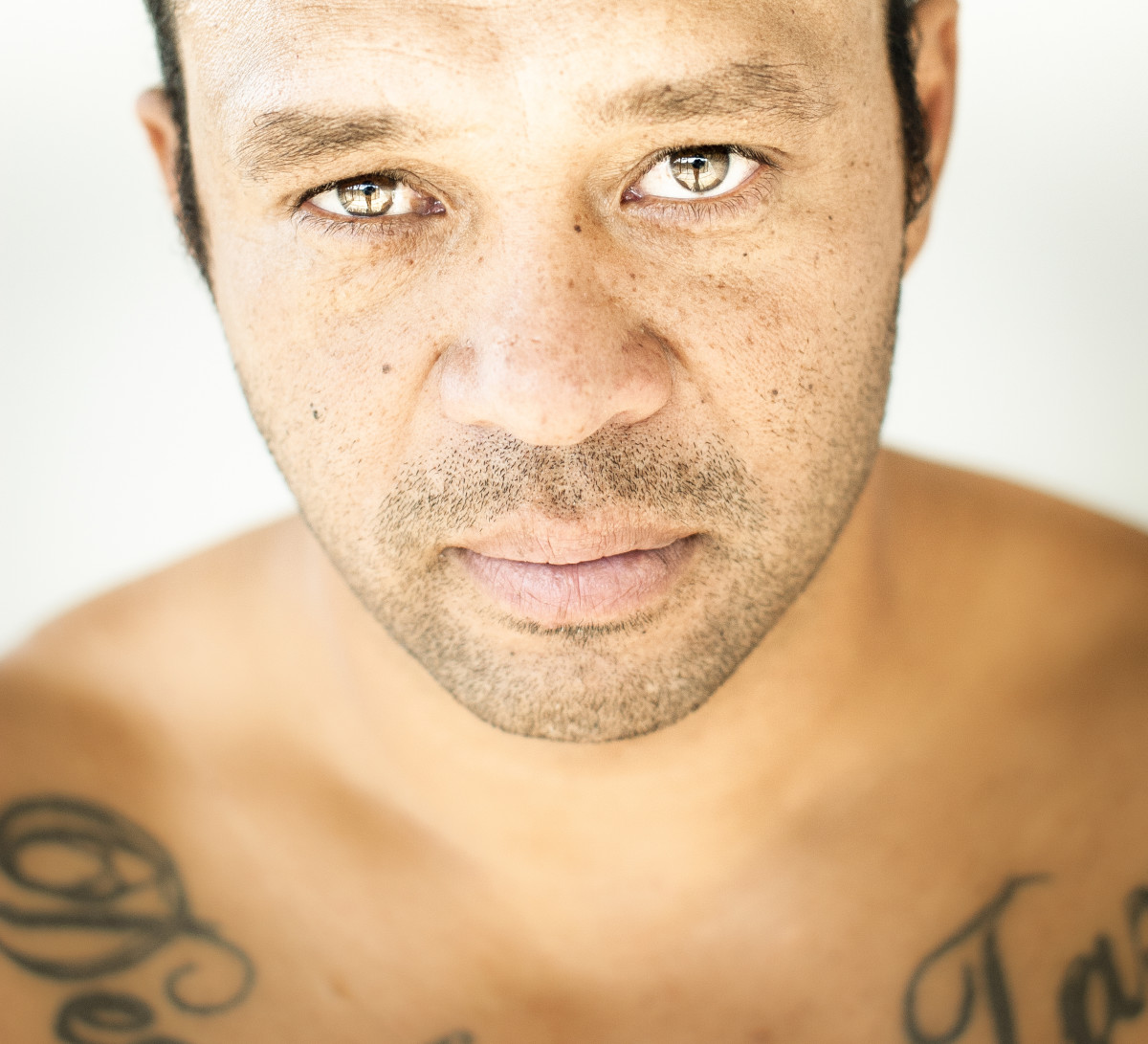Sunny Garcia Confirmed in Hospital ICU Surfer