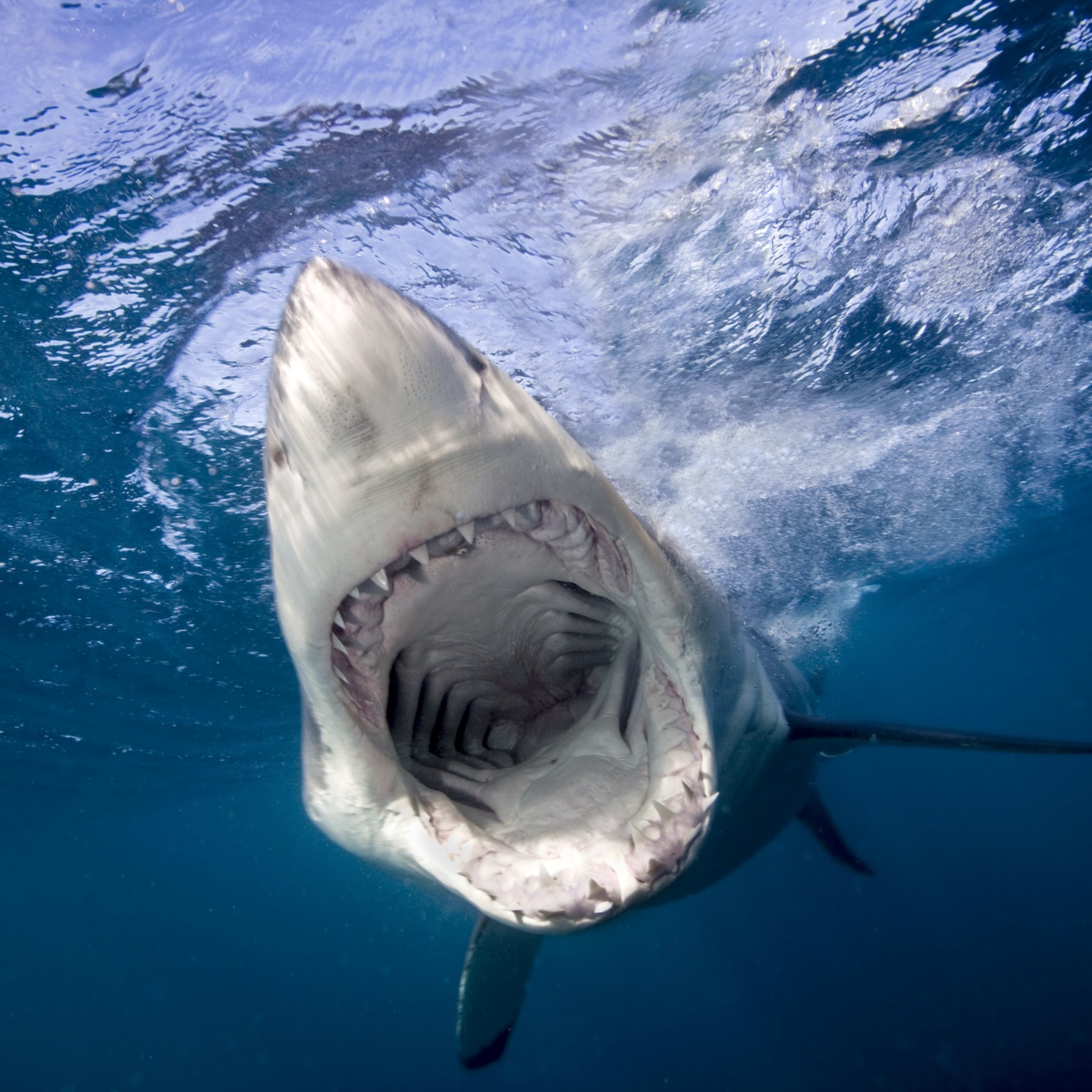 Shark Attack Survivor Loses Leg, Comes off Life Support: ‘Long Journey ...